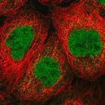 Merck Anti-SENP1 antibody produced in rabbit
