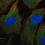 Merck Anti-MAP3K1 antibody produced in rabbit