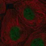 Merck Anti-RPA1 antibody produced in rabbit
