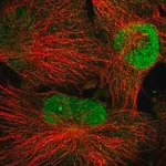 Merck Anti-WDR33 antibody produced in rabbit