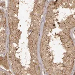 Merck Anti-CDK5RAP2 antibody produced in rabbit