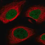 Merck Anti-MEF2A antibody produced in rabbit