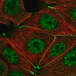 Merck Anti-TJP3 antibody produced in rabbit