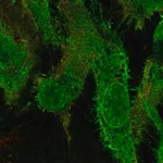 Merck Anti-GRK5 antibody produced in rabbit