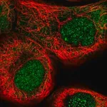 Merck Anti-NSUN5 antibody produced in rabbit