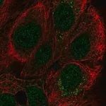 Merck Anti-CCDC144A antibody produced in rabbit
