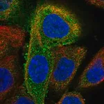 Merck Anti-DDX58 antibody produced in rabbit