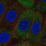 Merck Anti-NUP210L antibody produced in rabbit