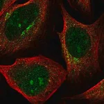 Merck Anti-PDK1 antibody produced in rabbit