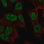 Merck Anti-RALYL antibody produced in rabbit