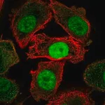 Merck Anti-JMJD6 antibody produced in rabbit