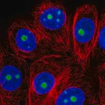 Merck Anti-SNRNP35 antibody produced in rabbit