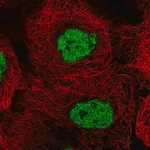 Merck Anti-CSNK2A1 antibody produced in rabbit