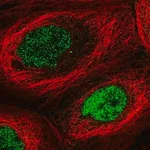 Merck Anti-N6AMT1 antibody produced in rabbit