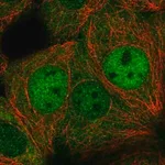 Merck Anti-DIP2C antibody produced in rabbit