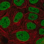 Merck Anti-PBRM1 antibody produced in rabbit
