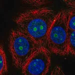 Merck Anti-ZNF771 antibody produced in rabbit