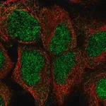 Merck Anti-HIC2 antibody produced in rabbit