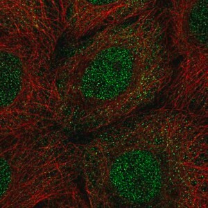 Merck Anti-PPP1R2 antibody produced in rabbit