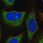 Merck Anti-TRIM39 antibody produced in rabbit