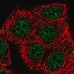 Merck Anti-SETD1B antibody produced in rabbit