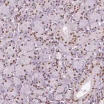 Merck Anti-DDX3X antibody produced in rabbit