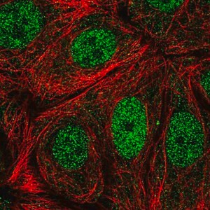 Merck Anti-CDK10 antibody produced in rabbit