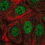 Merck Anti-CDK10 antibody produced in rabbit