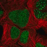 Merck Anti-ZNF32 antibody produced in rabbit