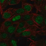 Merck Anti-FOXQ1 antibody produced in rabbit