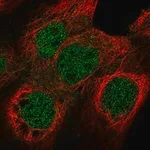 Merck Anti-NUF2 antibody produced in rabbit