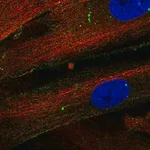 Merck Anti-THBS1 antibody produced in rabbit