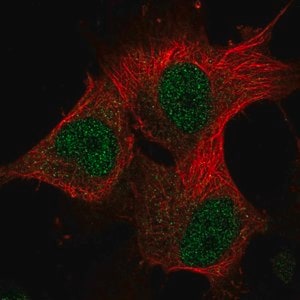 Merck Anti-METTL16 antibody produced in rabbit