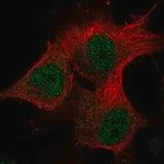 Merck Anti-METTL16 antibody produced in rabbit
