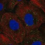 Merck Anti-TOP3B antibody produced in rabbit