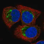 Merck Anti-ATP2C1 antibody produced in rabbit
