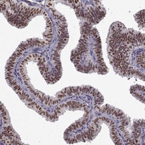 Merck Anti-PRMT1 antibody produced in rabbit