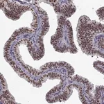 Merck Anti-PRMT1 antibody produced in rabbit