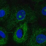 Merck Anti-MTUS1 antibody produced in rabbit