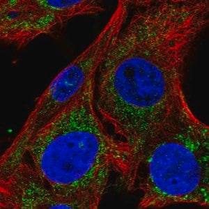Merck Anti-SLC25A34 antibody produced in rabbit
