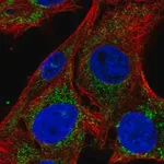 Merck Anti-SLC25A34 antibody produced in rabbit