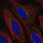 Merck Anti-ZNF469 antibody produced in rabbit