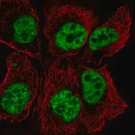 Merck Anti-TCERG1 antibody produced in rabbit