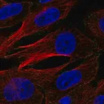 Merck Anti-AP2M1 antibody produced in rabbit