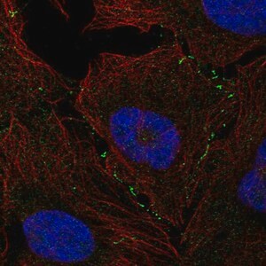 Merck Anti-VCAM1 antibody produced in rabbit