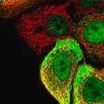 Merck Anti-SC5D antibody produced in rabbit