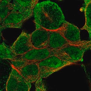 Merck Anti-NSD1 antibody produced in rabbit