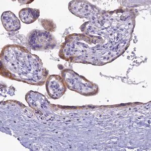 Merck Anti-CGB3 antibody produced in rabbit
