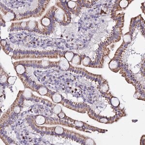 Merck Anti-SERP1 antibody produced in rabbit