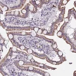 Merck Anti-SERP1 antibody produced in rabbit